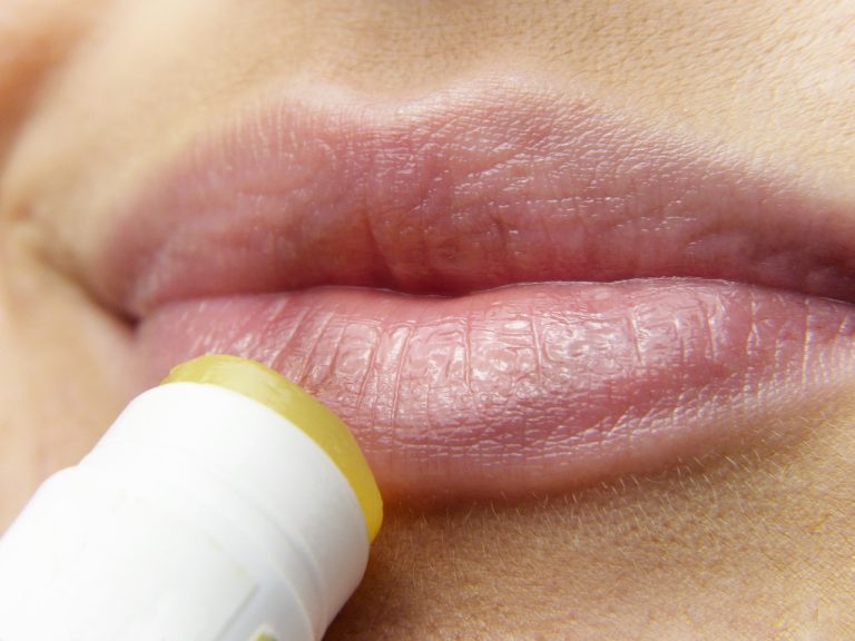 herpes buze