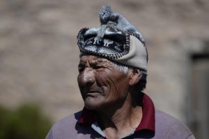 acid hialuronic riduri de expresie